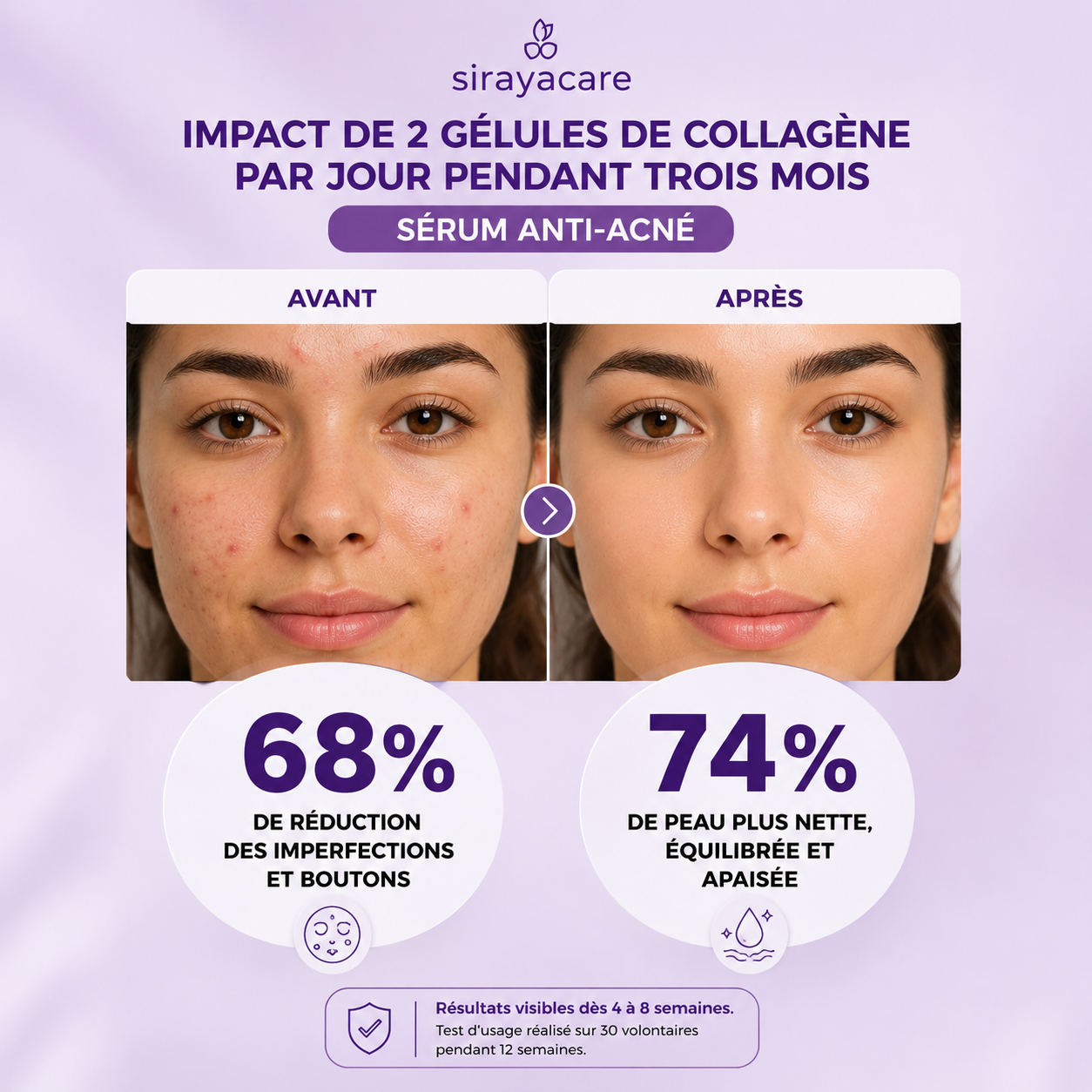 Sérum Anti-Acné Soin purifiant & peau plus nette