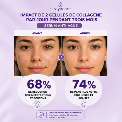 Sérum Anti-Acné Soin purifiant & peau plus nette
